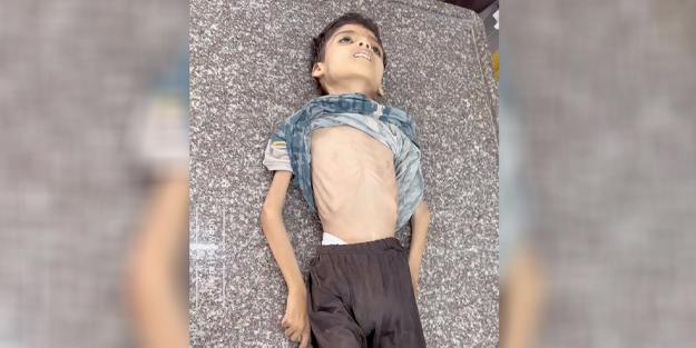 Gazze'de bir çocuk açlıktan öldü