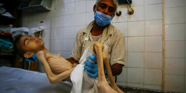 Gazze'de bir çocuk daha 'açlıktan' öldü!