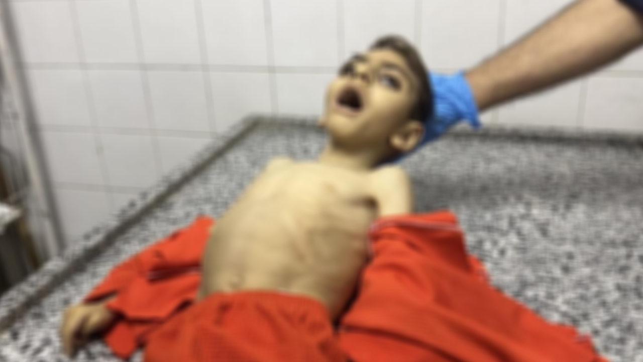 Gazze'de bir çocuk daha açlıktan öldü