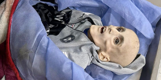 Gazze'de çocuklar açlıktan ölüyor!