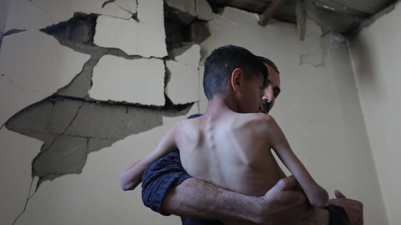 Gazze'de çocuklar ölümle pençeleşiyor