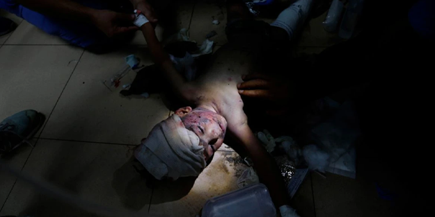 Gazze'de doktorlar, çocuğu cep telefonu ışığında tedavi etti