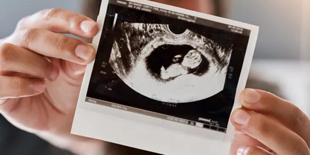 Gebelik döneminde doğru beslenme için anne adaylarına öneriler