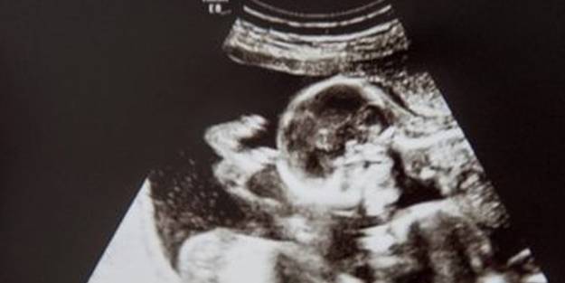 Gebelikte bazı testler hayati önem taşıyor