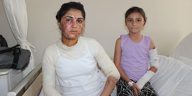 Gece uyurken bu hale getirdiler