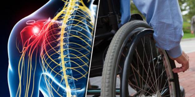 Geçmeyen baş ağrısına dikkat! Bu davranış felç riskini artırıyor