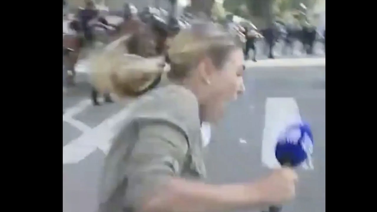 Gel vatandaş gel özgür basına gel! ABD polisi muhabiri bacağından vurdu