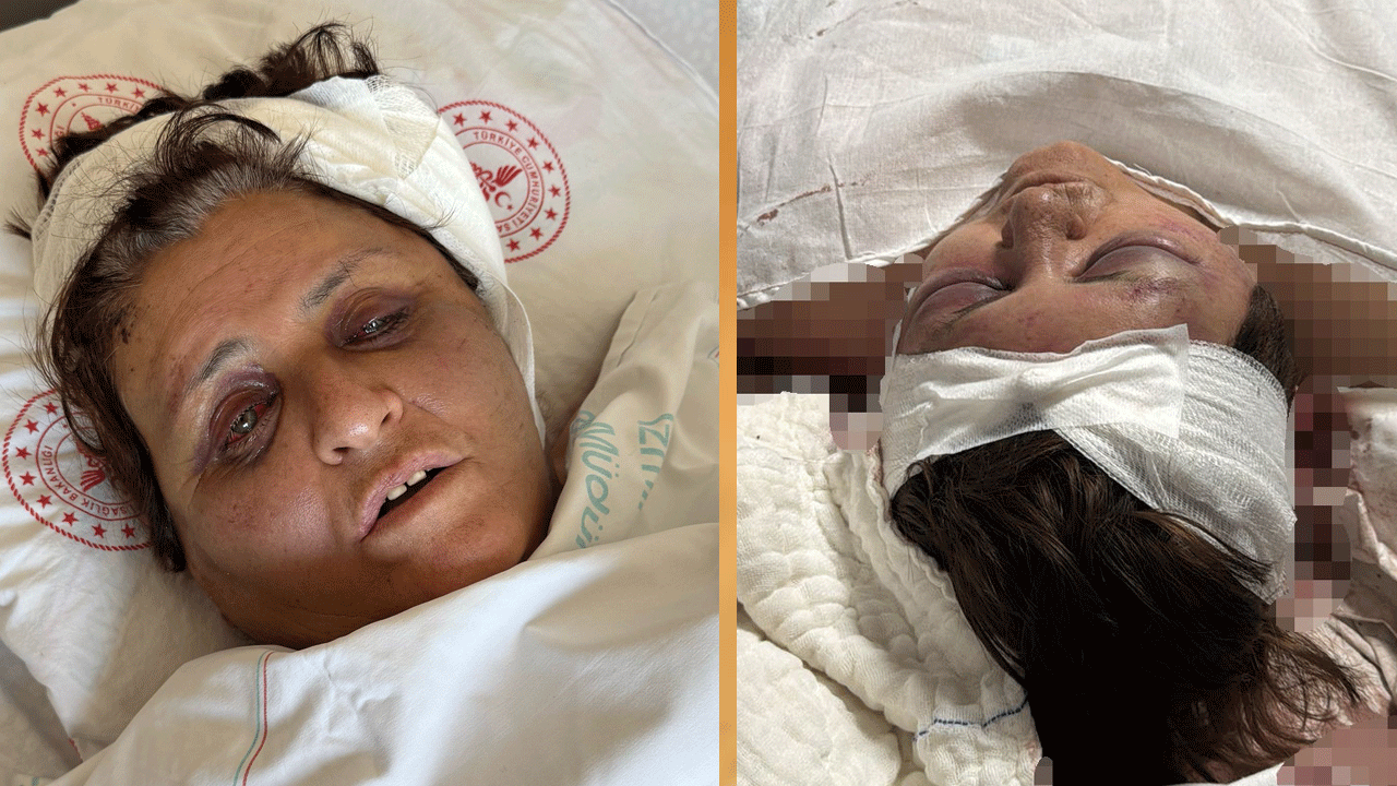 Gelini tuğla ile kafasını ezmişti! Talihsiz kayınvalide 11 gün sonra gözlerini açtı