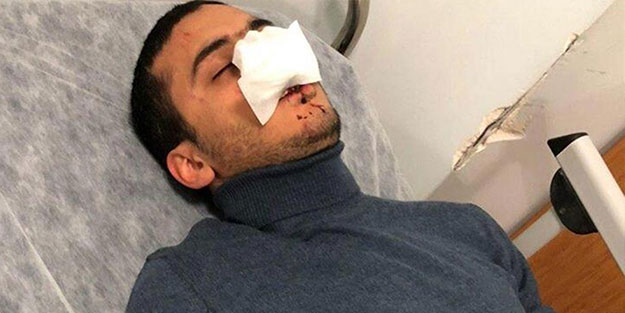 Genç oyuncuyu Suriyeli sanıp hastanelik ettiler