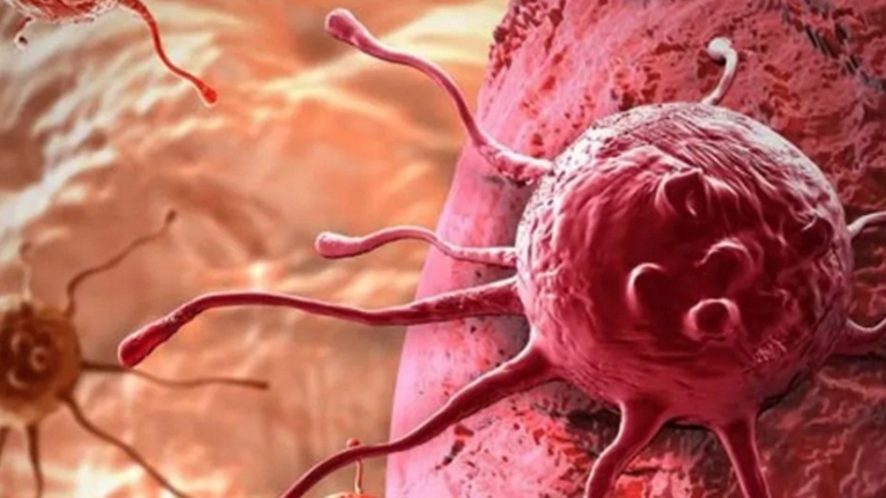 O kanser herkesi etkiliyor: Her yıl 1 milyon can alan o kanseri yok eden besin