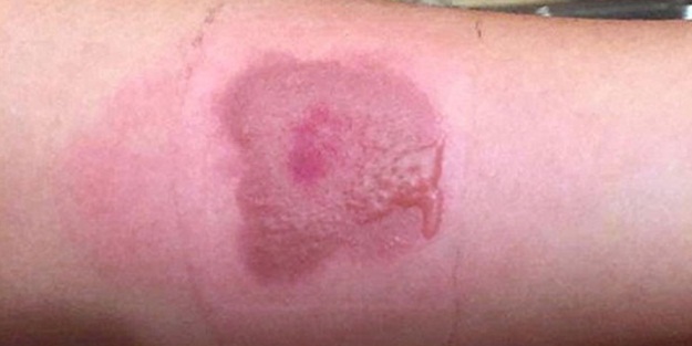 Gençler dikkat! Buna uymayın