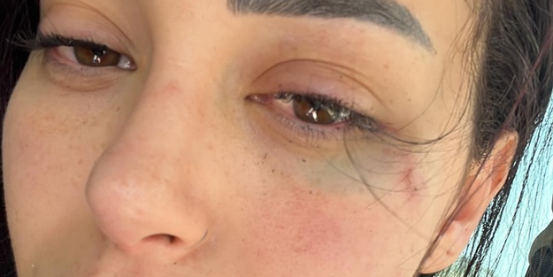 GKRY’de Türk kızına saldırı! 2 Rum tutuklandı