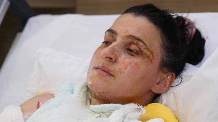 Gölcük'te jel yakıt anne- kızı hastanelik etti!