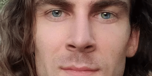 Gördüğünüzde çok şaşıracaksınız! En ilginç fiziksel özelliğe sahip 18 insan