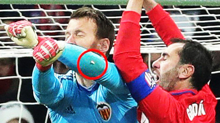 Görenler şok oldu! Futbolcunun dişi kalecini kolunda kaldı...