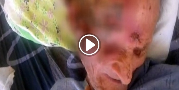 Görüntüleri yürek sızlatan yaşlı adam öldü