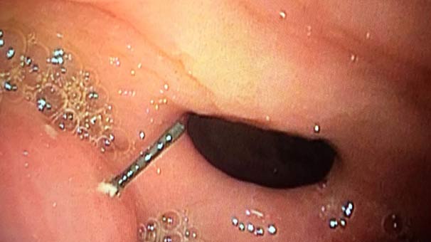 Görür görmez harekete geçtiler! Kışın yediği petek bal…