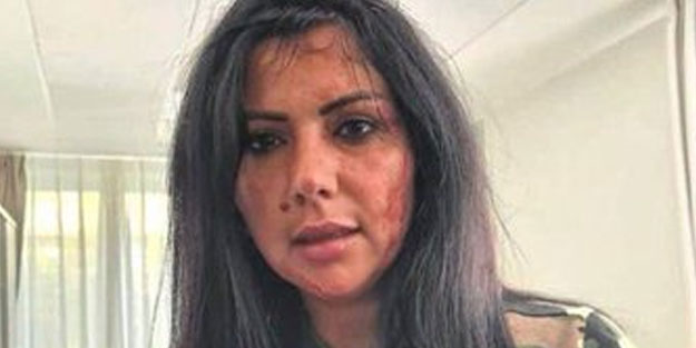 Gösteri düzenleyen Ermeniler gazeteciye saldırdı