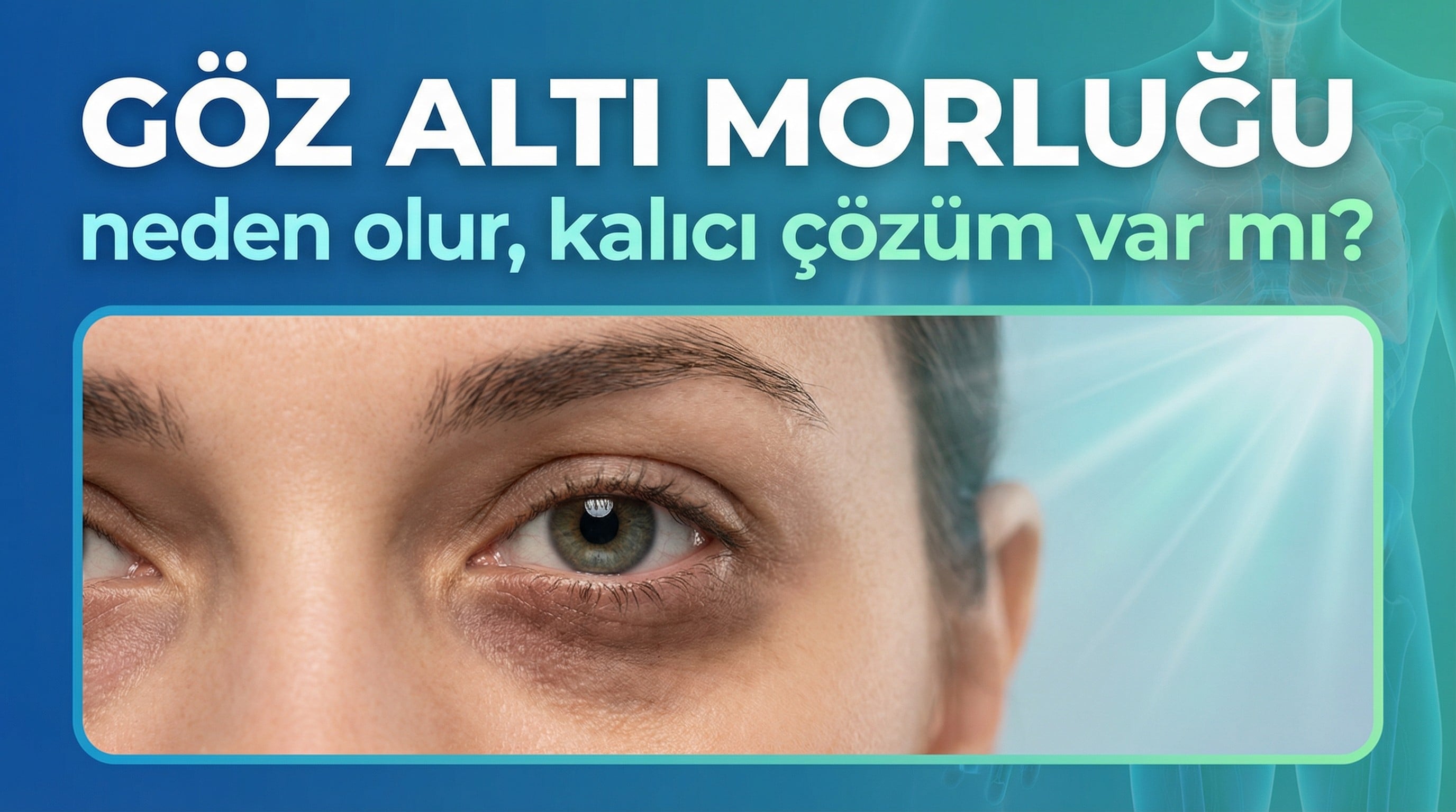 Göz altı morluğu neden olur, kalıcı çözüm var mı?