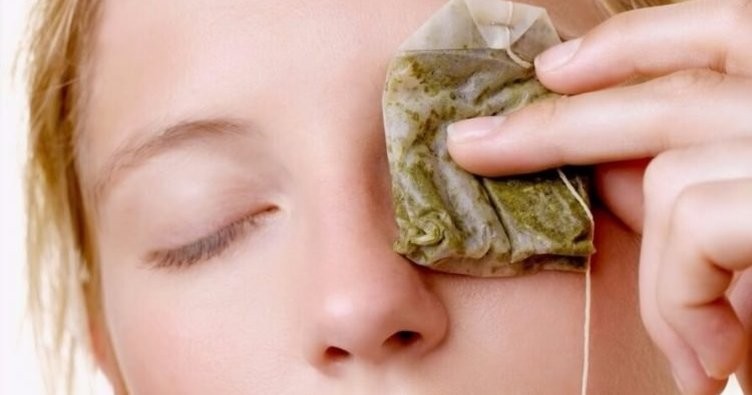 Göz altı morlukları için kolay yöntemler