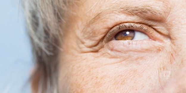 Göz altı torbasını geçirmenin yolları