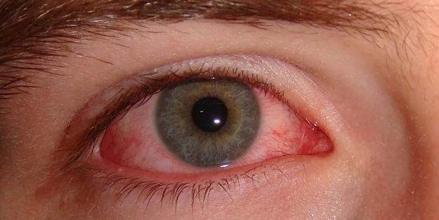 Göz ameliyatında 'biyonik' dönem!