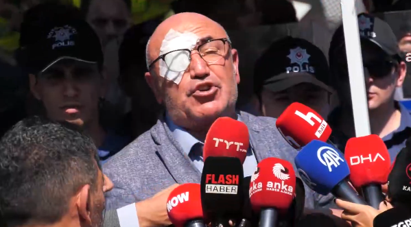 Göz gidince Tanal saçmaladı! Şovmen Mahmut kaldığı yerden devam...