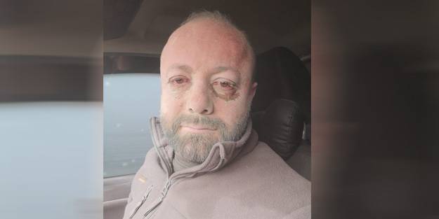 Göz gözü görmüyor! Kum fırtınası bu hale getirdi