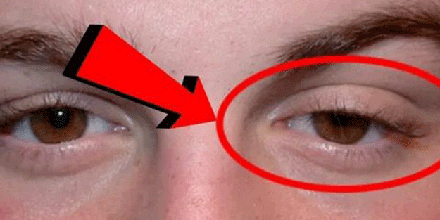 Göz kapağı düşük olanlar dikkat! Bu hareket ve maskeyle kaldırılabiliyor