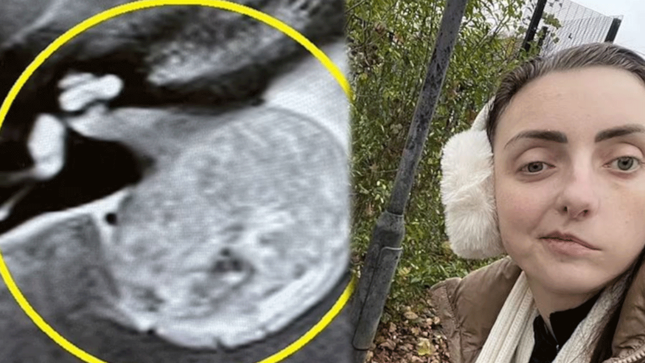 Göz seğirmesinin altından bakın ne çıktı! Hastaneye gidince acı gerçekle yüzleşti