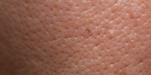 Gözenekler neden belirginleşir?