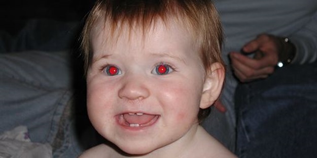 Gözler neden fotoğraflarda kırmızı çıkar?