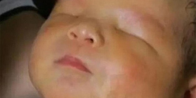 Gözleri olmadan doğdu!