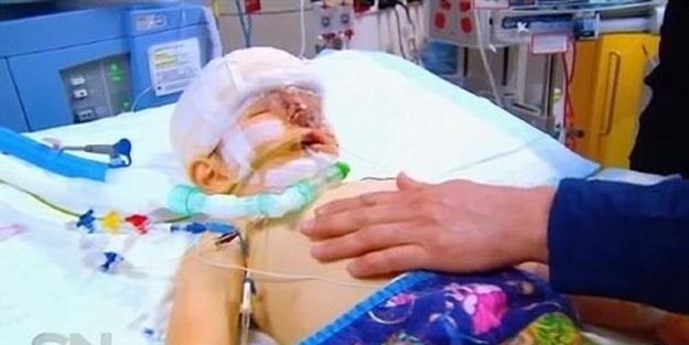 Gözleri ve burnu olmadan doğdu - FOTO