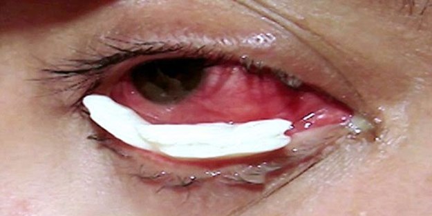 Gözlerinden kristal dökülüyor