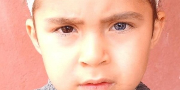 Gözlerini görenler inanamıyor!