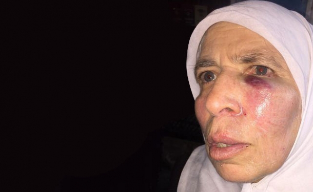 Gözü dönmüş alçaktan yaşlı teyzeye 'Evet' dayağı!