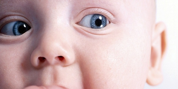 Gözümüzden bile sakındığımız, gözümüzün nuru bebeklerimizin: Göz sorunu...