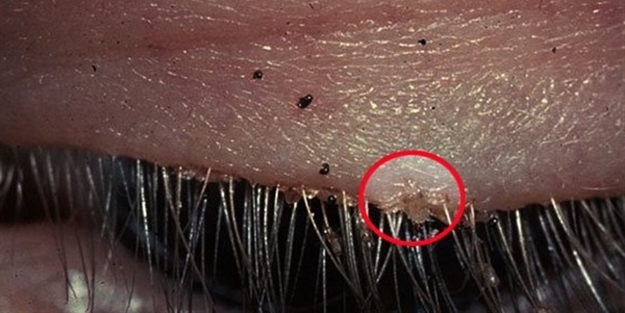 Gözünden çıkanlar hayrete düşürdü