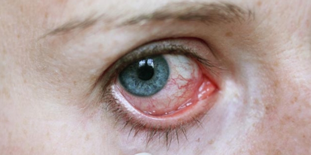 Gözünüzde taş olabilir!