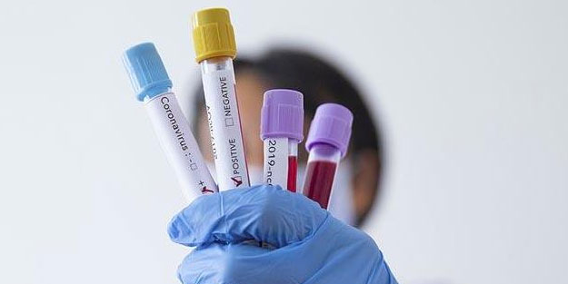 Guatemala'da corona virüsten ilk ölüm gerçekleşti