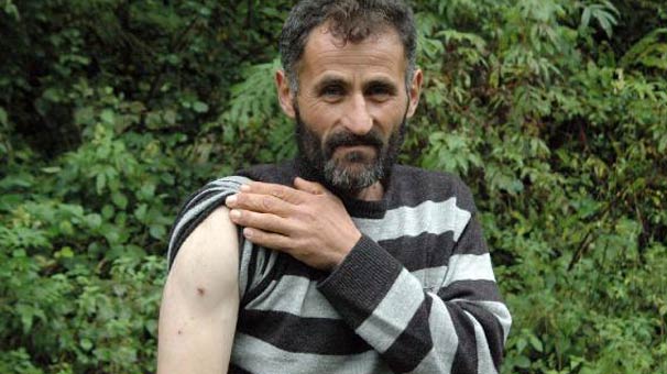 Gümüşhane'de kendisine saldıran ayıya yumruk attı, kurtuldu