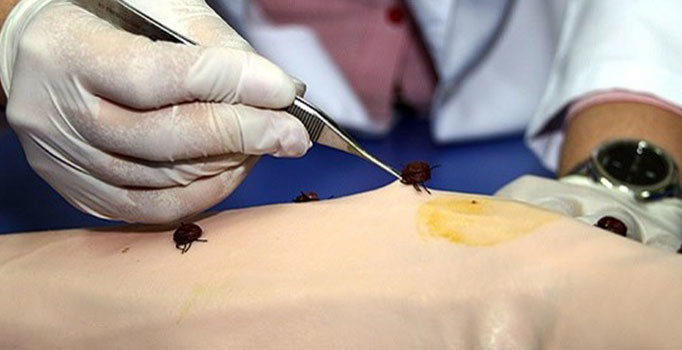 Gümüşhane'de kene can aldı