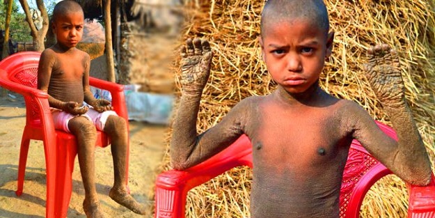 Günden güne taşa dönüşüyor!