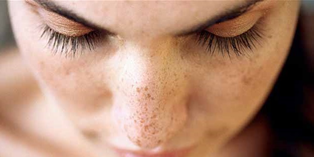 Güneş lekelerinden korunmak çok basit!