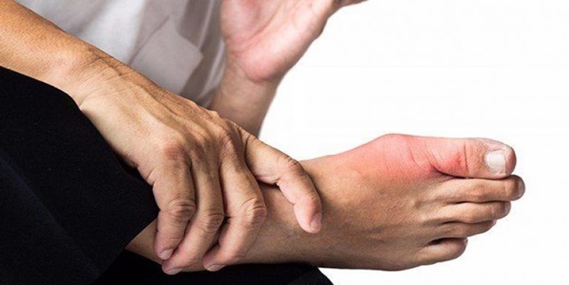 Gut hastalığı nedir?