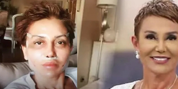 Güzellik uğruna dilsiz kaldı! Yok artık dedirtti...