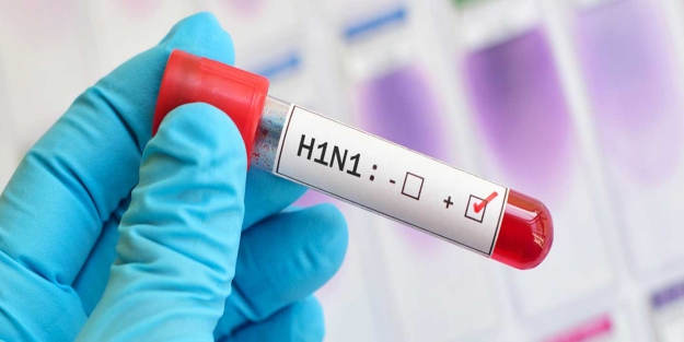 H1N1 virüsü nedir?
