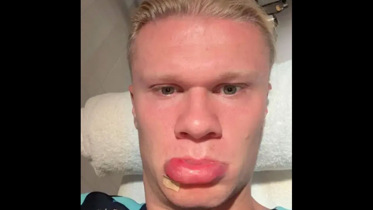 Haaland'ın şaftı kaydı