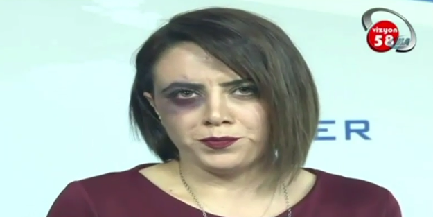 Haber bültenine öyle bir halde çıktı ki...